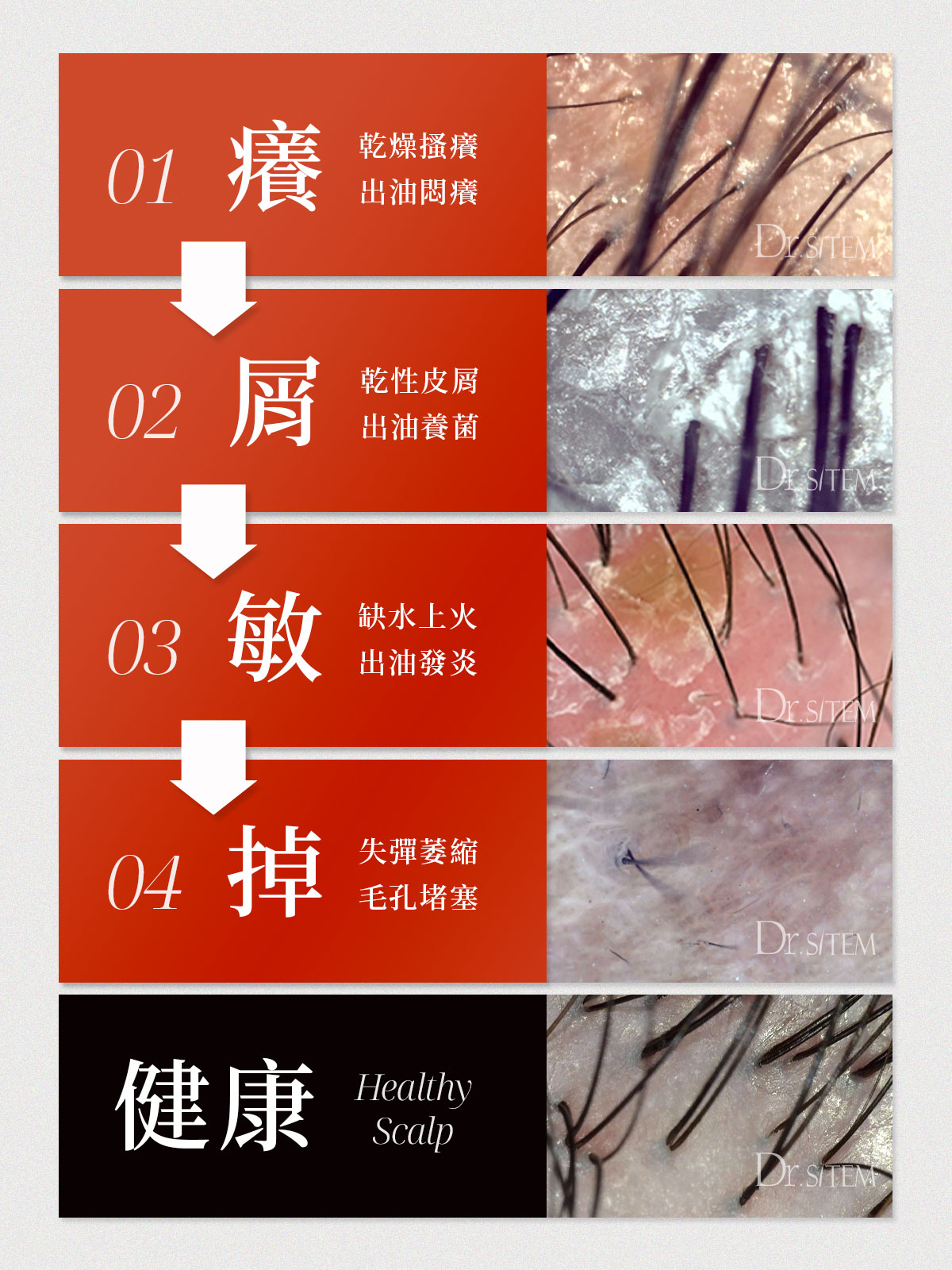 啟動毛囊的關鍵解密:Dr. Sitem絲展的自然生髮管理與頭皮毛囊檢測-生髮關鍵1